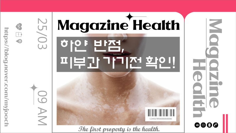 백반증 생기는 원인 초기증상 치료받기 전에 확인!