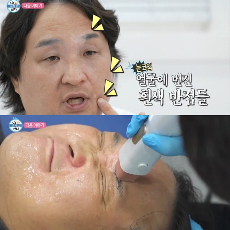 배우 <b>구성환</b> 난치병 <b>백반증 투병</b>! 증상, 원인, 이유, 치료... 