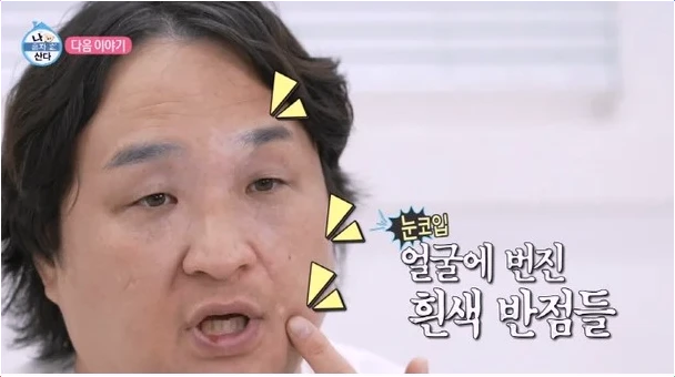  구성환 응급실行 부른 난치병 고백과 현재 상황!