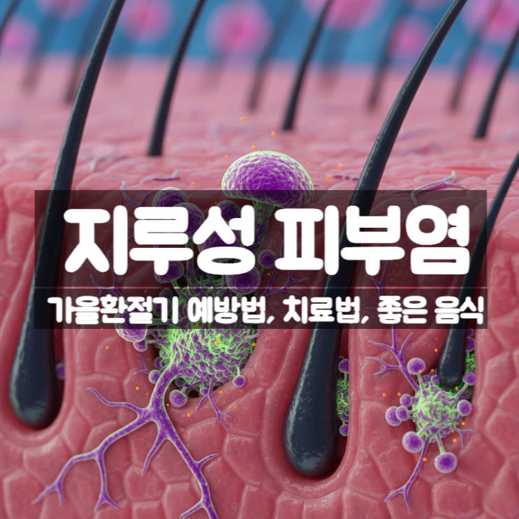  가을 환절기 지루성 피부염 예방법 치료법 관리방법 좋은 음식