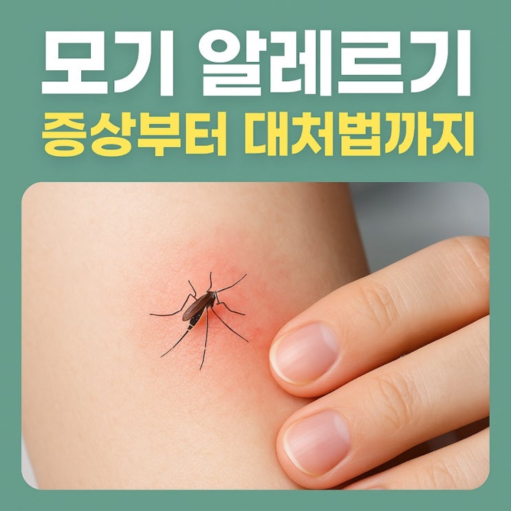  모기 알레르기 증상부터 대처법까지  가려움·부기 잡는 완벽 가이드!