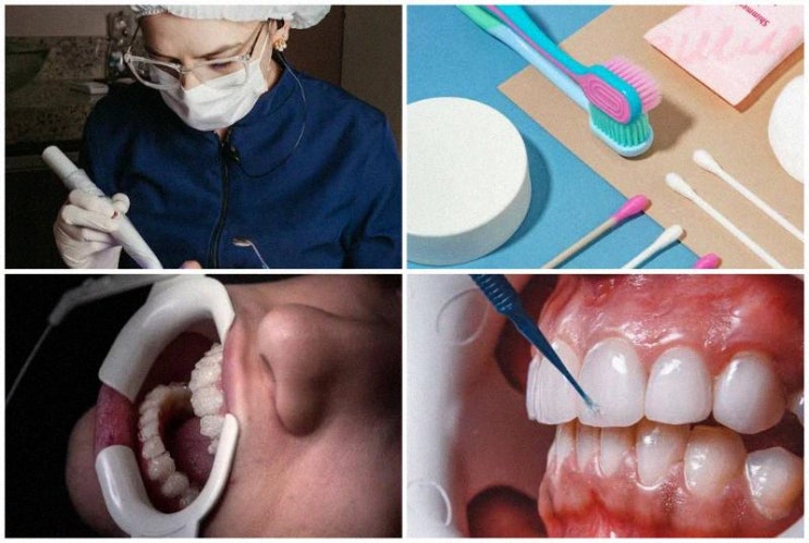 꿀잠 보장! 이갈이 방지 마우스피스의 세계와 치아 관리법 대공개 데쓰!