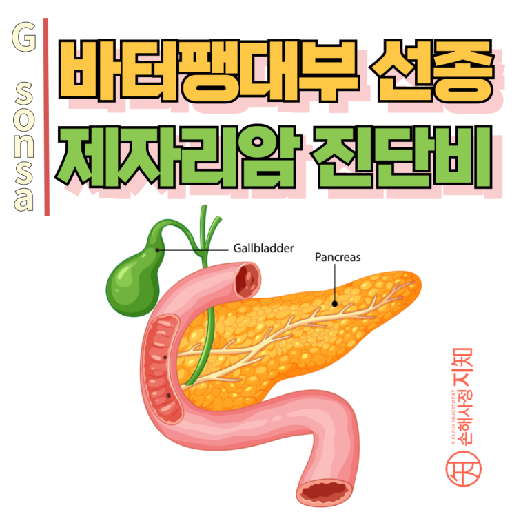  바터팽대부 선종, 생소한데 제자리암 진단비 받을 수 있을까? - [보험금, BA+DA]