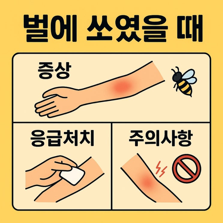  벌에 쏘였을 때 증상·응급처치·주의사항 총정리  | 야외활동 전 꼭 알아두세요!