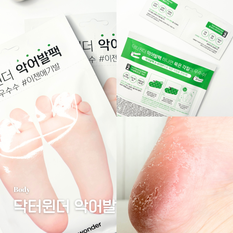 껍질처럼 벗겨진 발 뒷꿈치 각질 제거, 발바닥 셀프 관리 후기 : 네이버 블로그