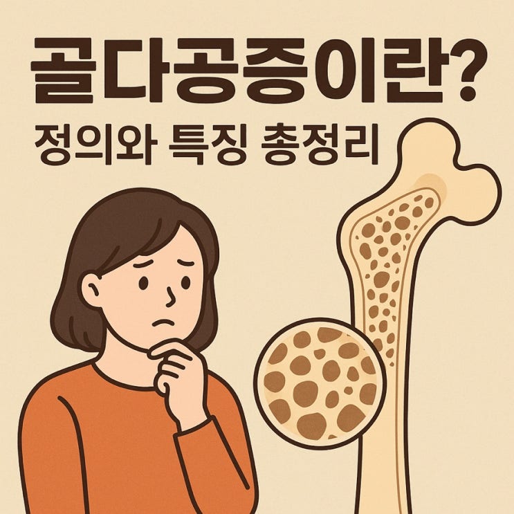  골다공증이란? 정의와 특징 총정리