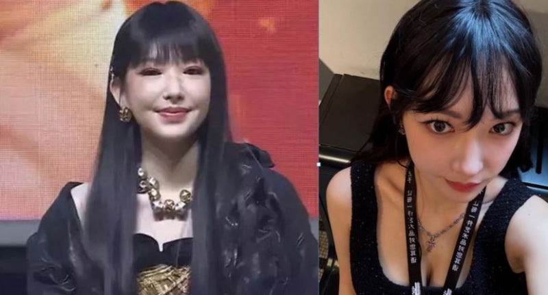 성소 우주소녀 중국 가수 인스타 근황 비주얼 성형 의혹? 저혈압 약 부작용