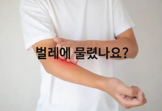 진드기 지네 개미 벌레 물린 자국 특징 대처방법 치료법
