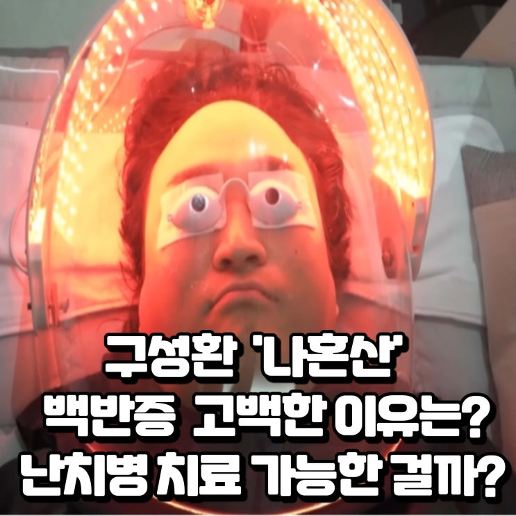  구성환 백반증 투병 고백 나혼산 백반증치료 방법은?