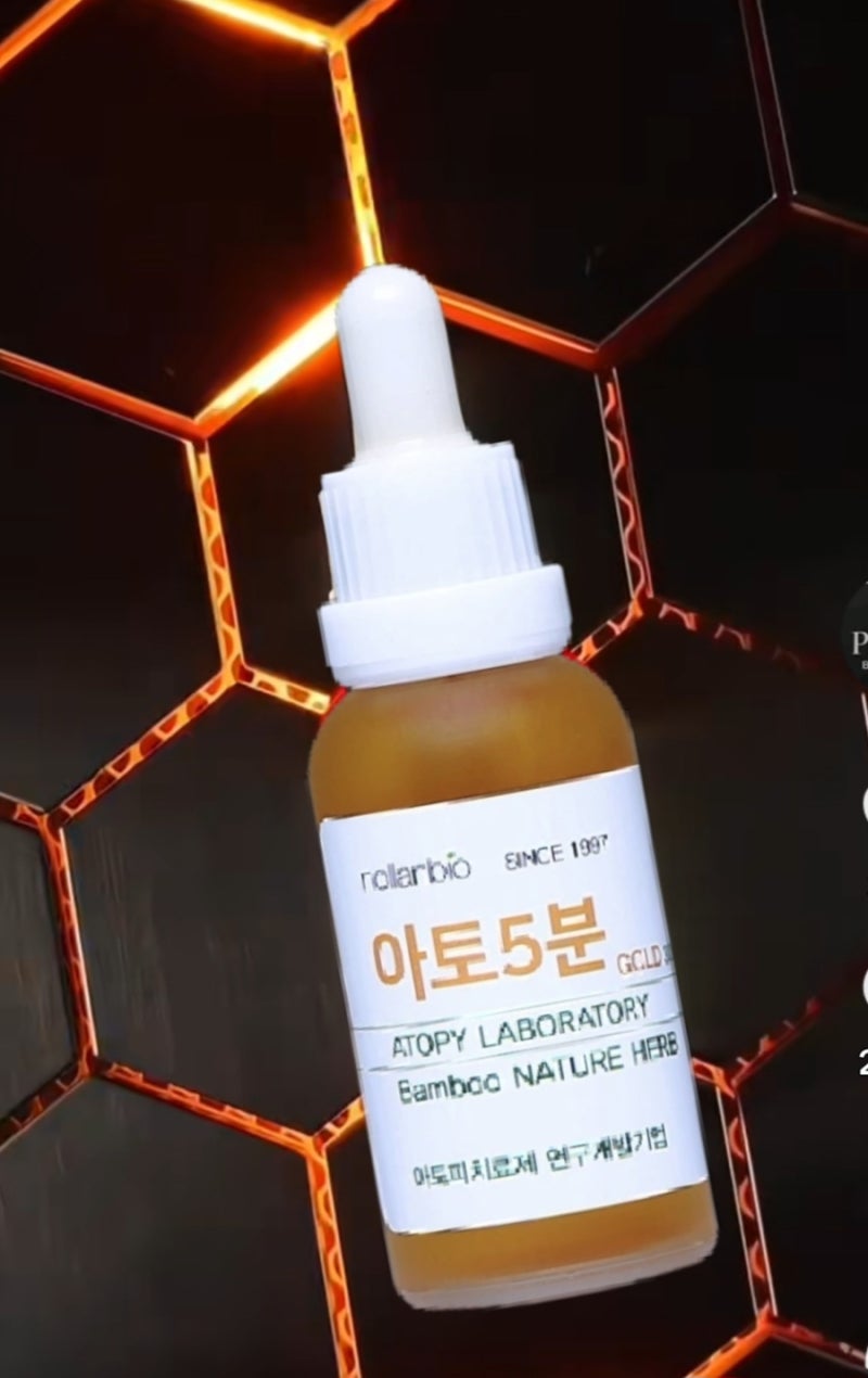 아토피 피부염 치료 잘하는 명의 아토5분
