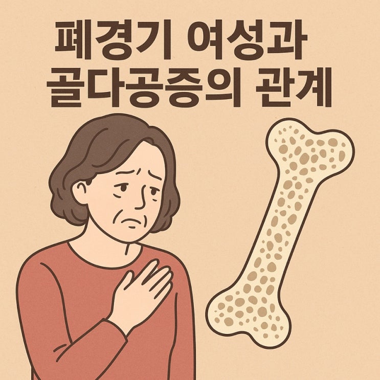  폐경기 여성과 골다공증의 관계 — 조용히 진행되는 뼈 약화