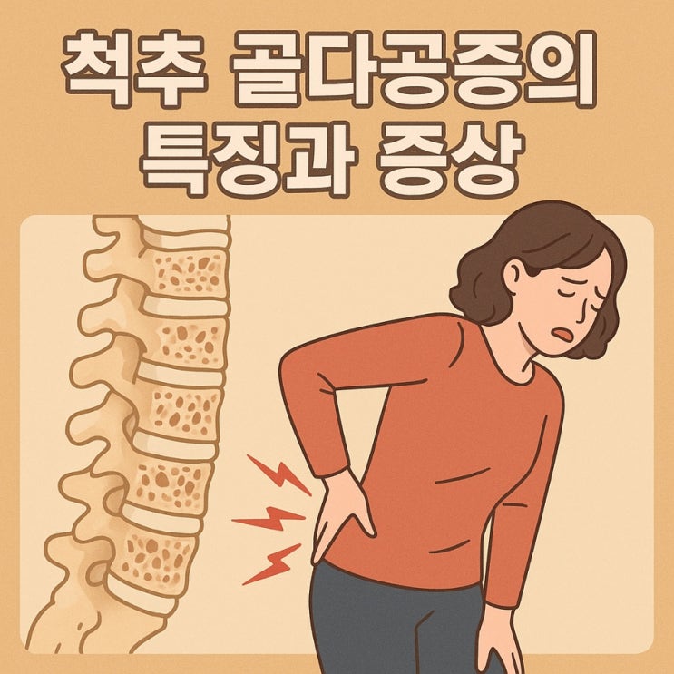  척추 골다공증의 특징과 증상 — 허리가 보내는 경고 신호