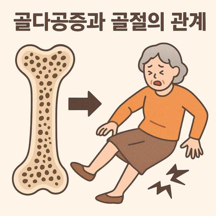  골다공증과 골절의 관계 | 뼈가 약해지면 생기는 위험한 결과 조기 예방법까지 총정리!