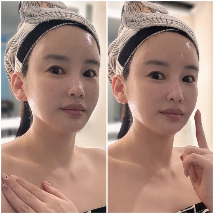  부산 슈퍼젝션 최정윤피부연구소 얼굴 예민 홍조 피지 트러블 올인원 케어