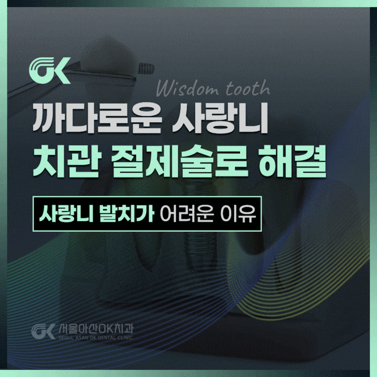  까다로운 하남사랑니발치, 치관 절제술로 신경 손상 위험 줄이기