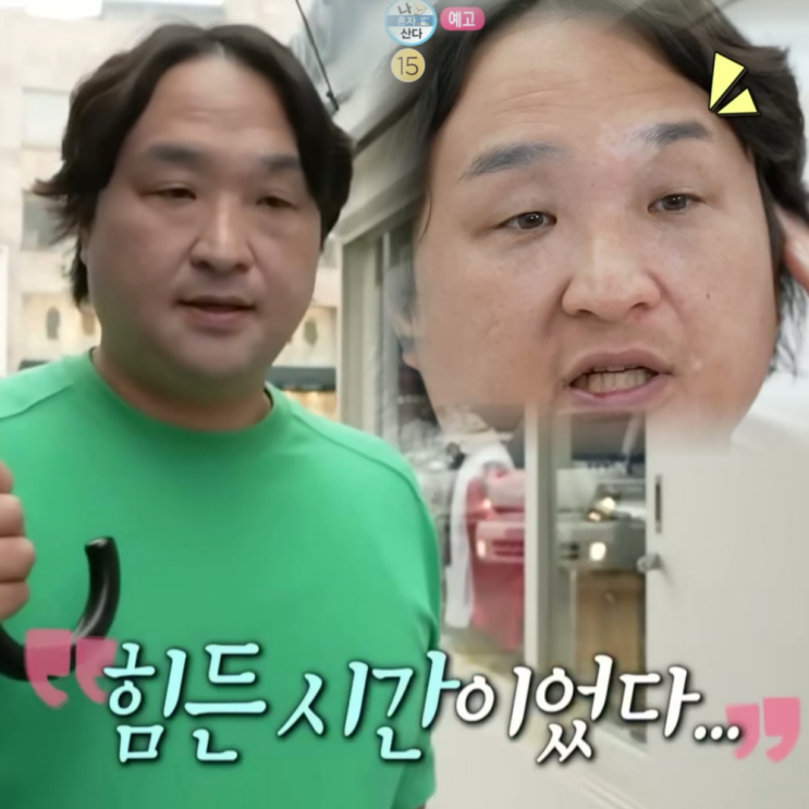 나혼산 <b>구성환 백반증</b> 원인과 증상 뭘까? 치료 방법