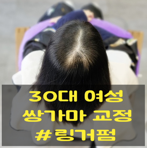  쌍가마 가르마 고민 해결! 탈모처럼 보이는 정수리, 링거펌으로 완성