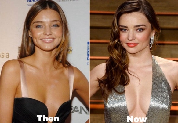 miranda kerr 미란다 커 근황 및 성형수술 흔적