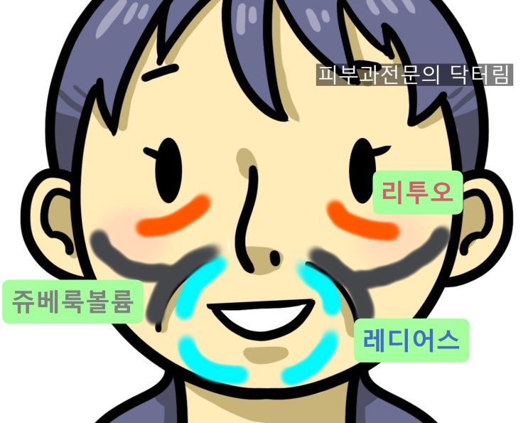 리투오, 쥬베룩볼륨, 레디어스 - 효과 비교, 추천 부위