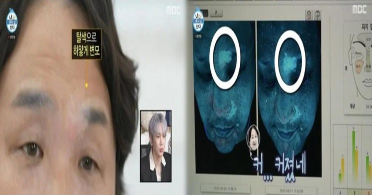 <b>구성환</b>, <b>백반증</b> 악화 고백 “살찐 만큼 번졌다”…눈썹까지... 