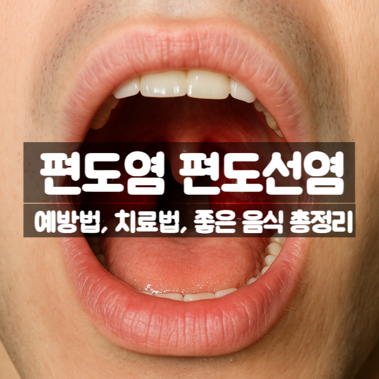 가을 환절기 편도염 편도선염 예방법 치료법 좋은 음식