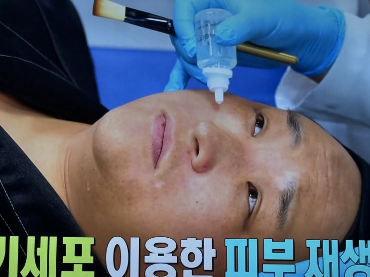 나혼산 <b>구성환</b> 햄버거 피부과 <b>백반증</b> 병원 이태원 미국식... 