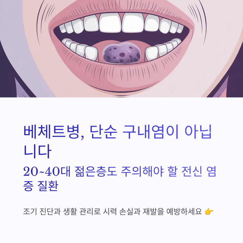 베체트병 진단 기준과 관리법 총정리 – 구내염부터 실명 예방까지