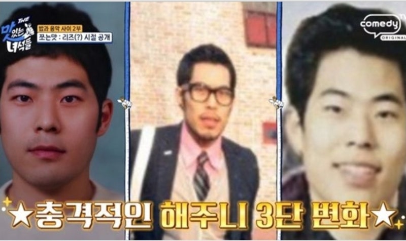 김승혜♥' 김해준, 성형 의혹 불거졌다…"치아 교정만" 해명에도 논란 (THE 맛녀석)
