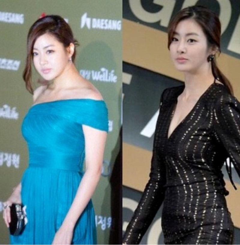 ♀️ “하루 5분이면 충분해요!” 배우 강소라, 직접 알려준 거북목 교정 스트레칭 루틴 공개