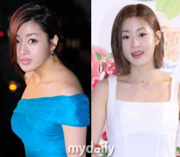  “하루 5분이면 거북목 탈출!” ️배우 강소라가 직접 공개한 ‘실전 거북목 교정 루틴’