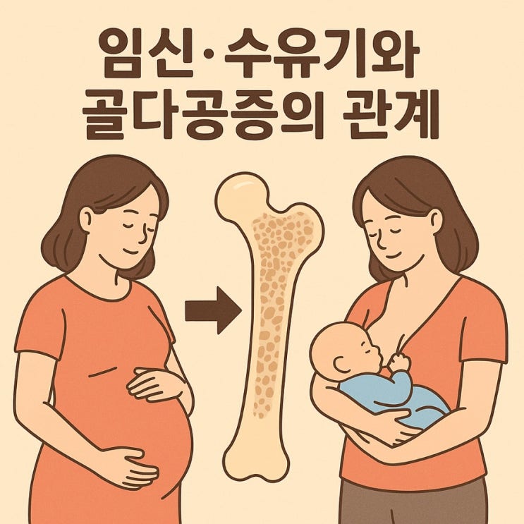  임신·수유기 여성, 뼈 건강 주의보  골다공증 위험과 예방법 완벽 가이드