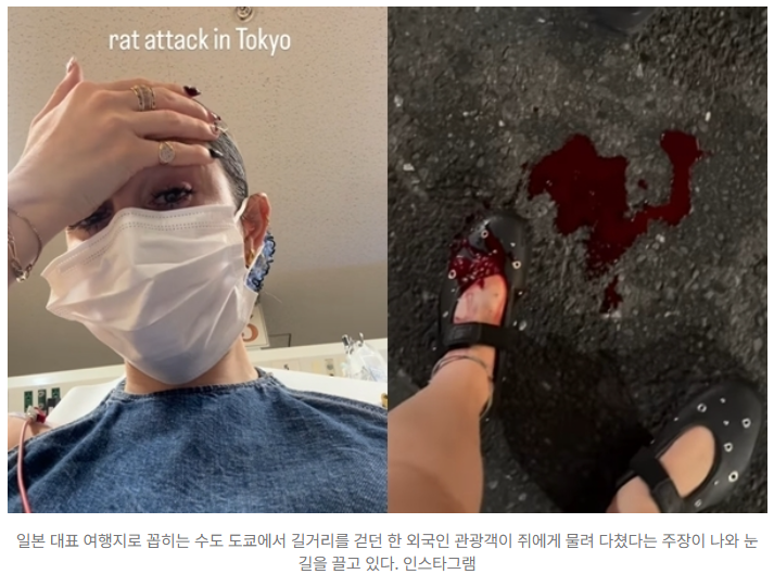  “도쿄 한복판에서 쥐에 물렸다?!” 신주쿠 거리서 외국인 관광객 피범벅… 日 ‘도시 쥐 공포’ 확산 중️