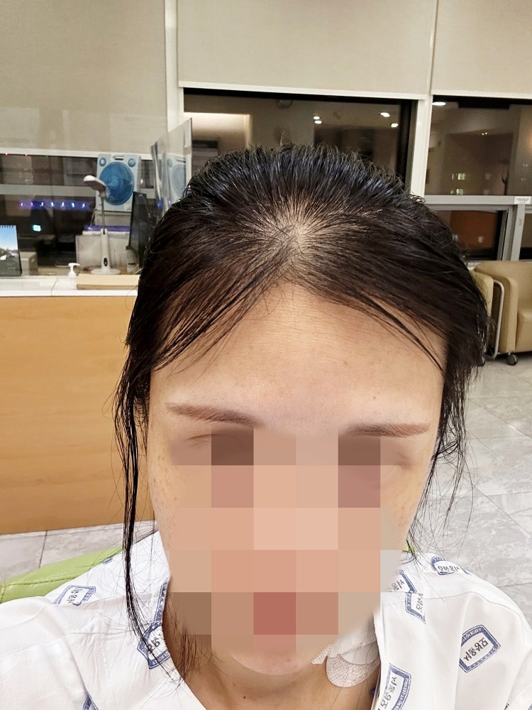 노린스 드라이 샴푸, 클린라이프 사용법 독특하네요!