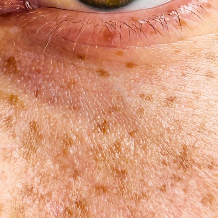  피부하얘지는법, 진짜 가능한가요? 글루타치온 효과까지 완전 정리!
