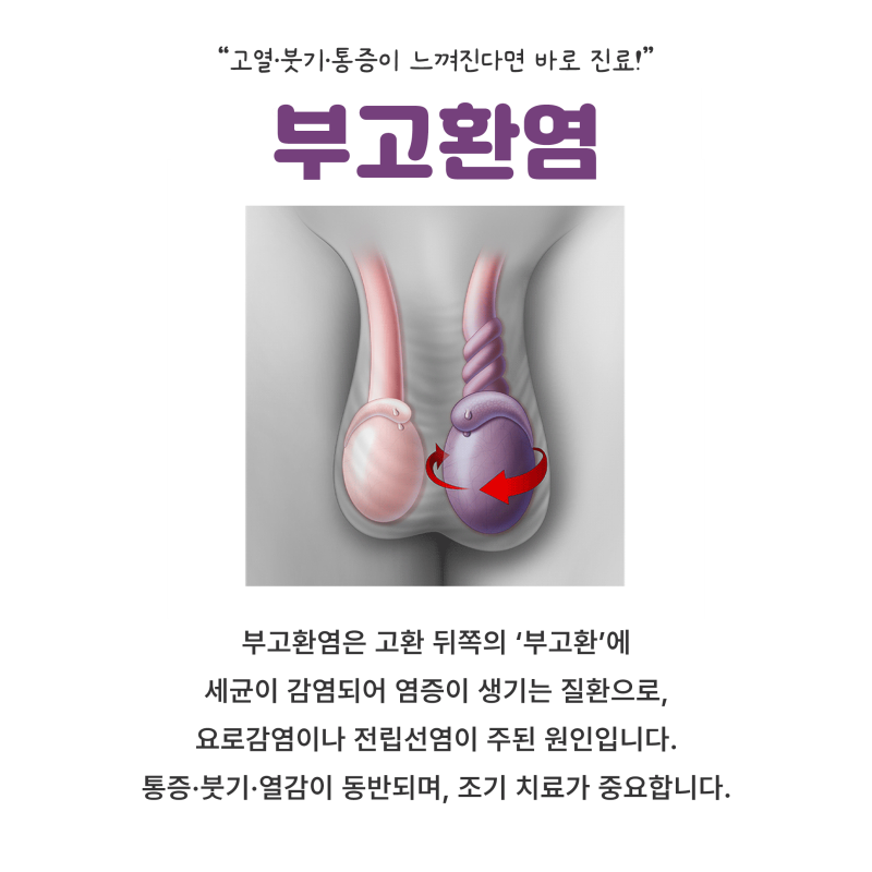 갑작스러운 고환 통증? 부고환염, 원인부터 치료까지 한눈에!
