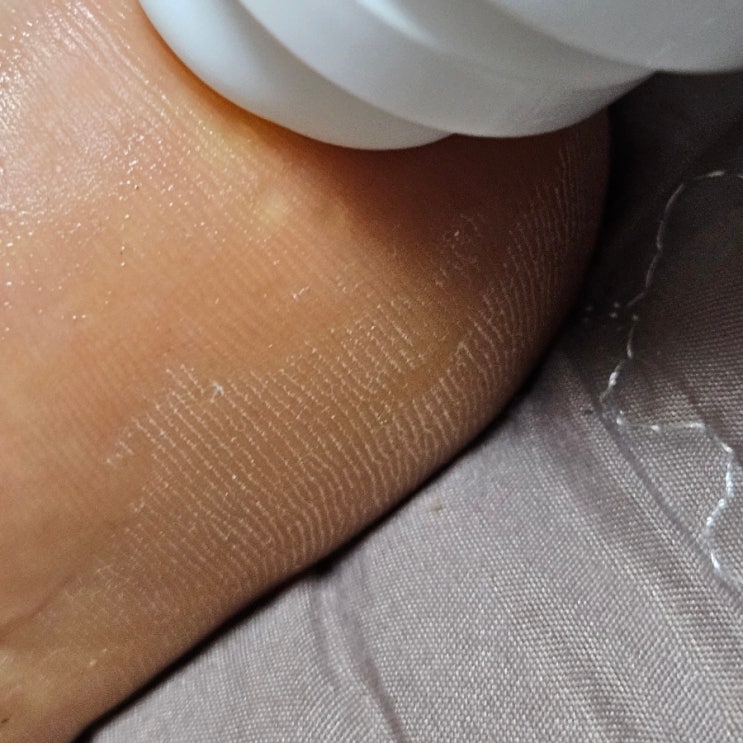  발바닥건조한 50대 60대 아빠 선물로 좋은 푸토닉 발보습액 마사지도됨