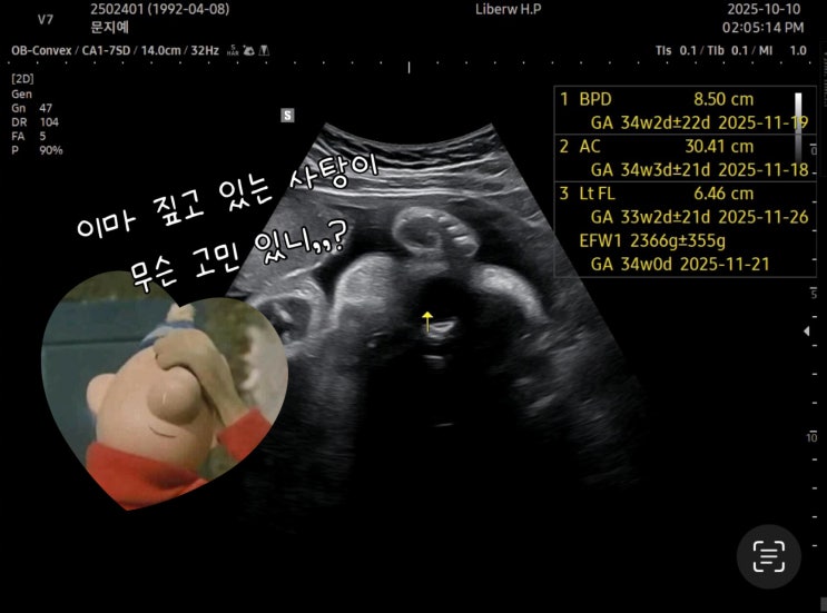  수원 리베르 여성병원 | 33주차 정기검진 및 독감 무료 접종