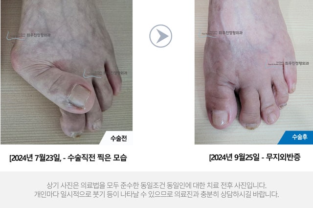 족부전문의 명의 지속적인 통증, 믿을 수 있는 결과를 확인하세요