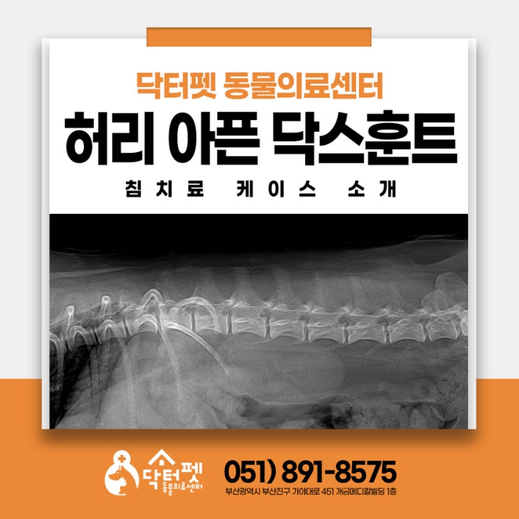  10살 닥스훈트 갑자기 다리를 못 썼던 이유! 디스크 의심 케이스 강아지 침치료 CVA 부산 가야 동물병원