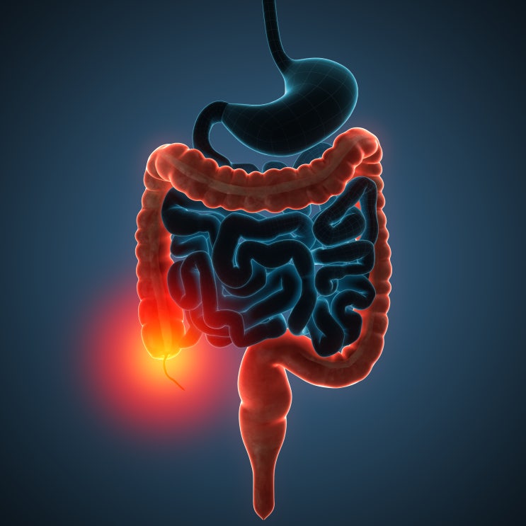  PEMF (자기장치료), IBD 환자의 통증·염증 관리에 어떻게 활용될 수 있을까?