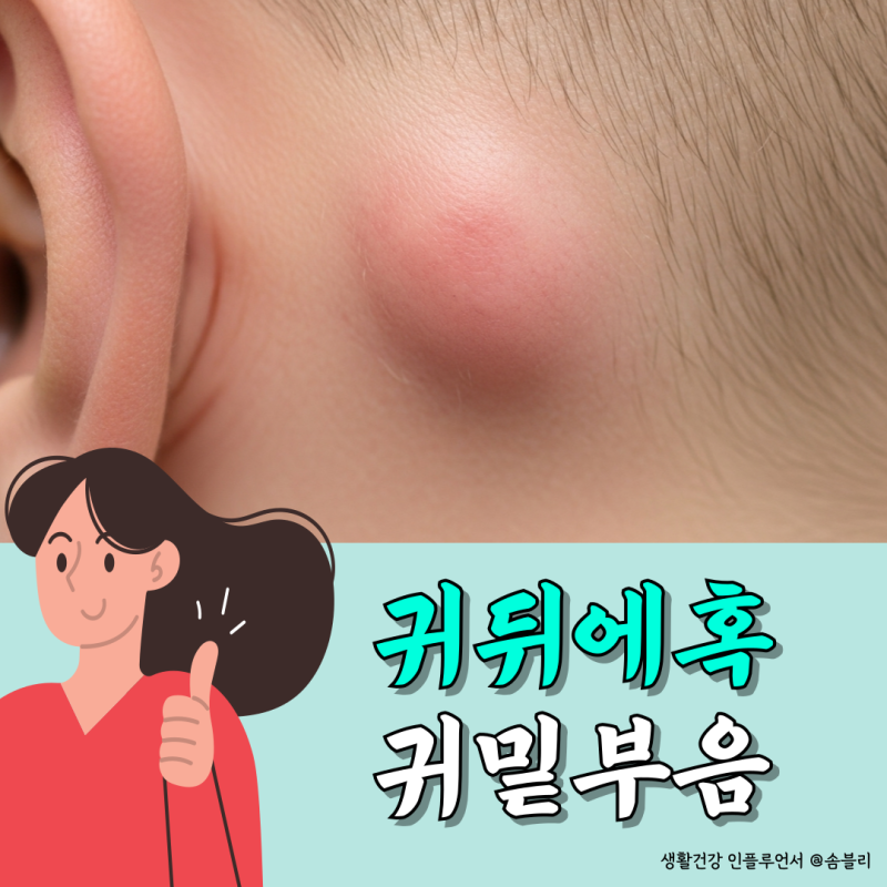 귀뒤에혹 귀밑부음 뭐 때문에 생긴걸까
