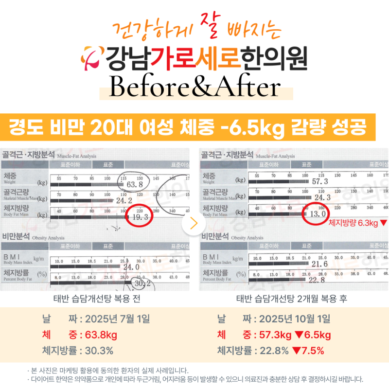 [강남 다이어트 한의원] 미레나 이후 체중 증가? 술 마시면서도 체지방 -6.3kg 성공한 예비신부....