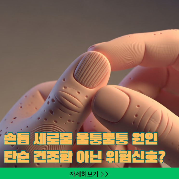  암 치료비 1억 아끼는 손톱 '검은색 세로줄', 피부암(흑색종) 골든타임 체크리스트