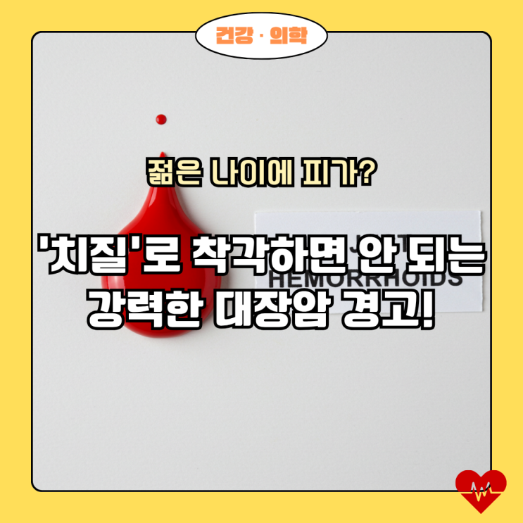  젊은 대장암 초기 증상: 단순 치질로 오인하면 안 되는 '이것'
