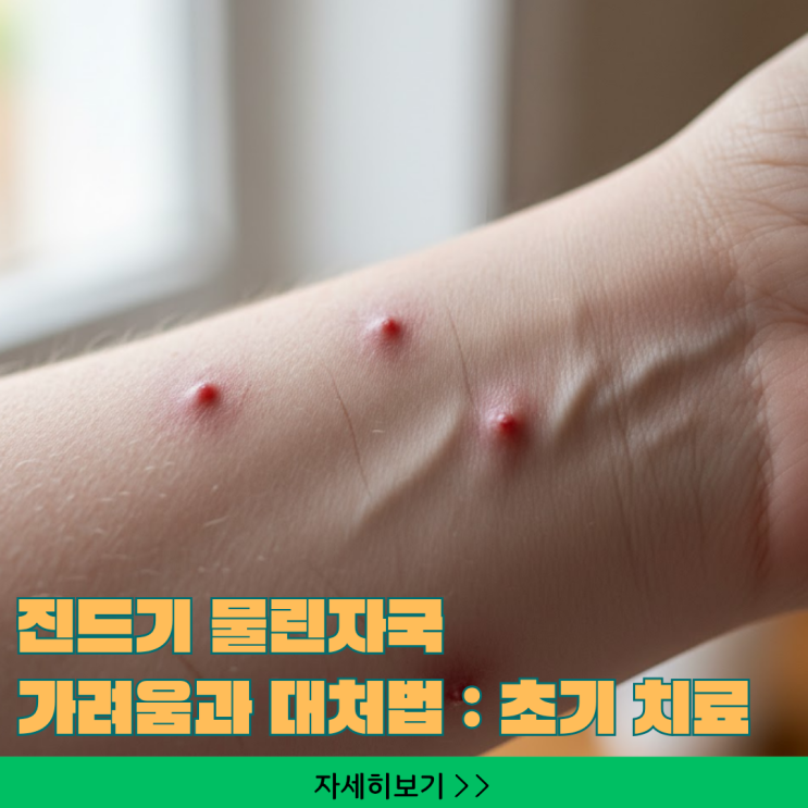  벌레 물림 vs 진드기: '이 증상' 놓치면 병원비 10배 폭탄 맞는 위험 신호