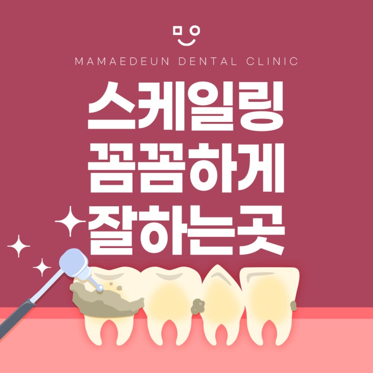  부평 스케일링 건강한 치아를 지키는 가장 쉬운 방법