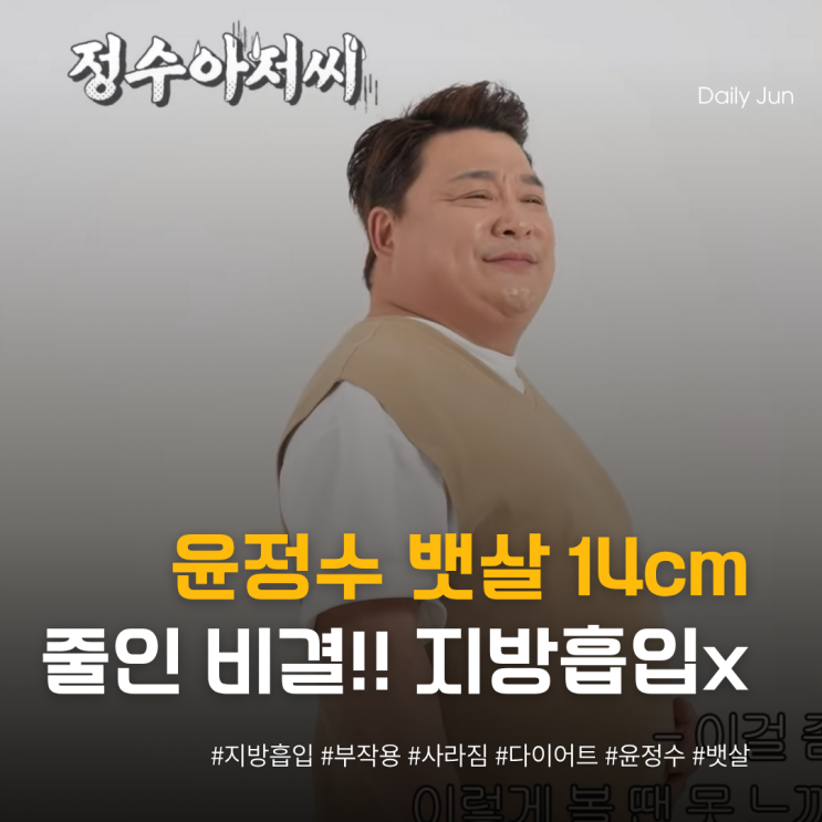  지방흡입 부작용 사라졌다! 윤정수, 뱃살 14cm 줄인 비결