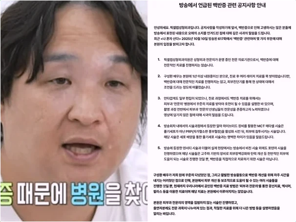  배우 구성환 백반증 이슈 성형외과 즉각 해명