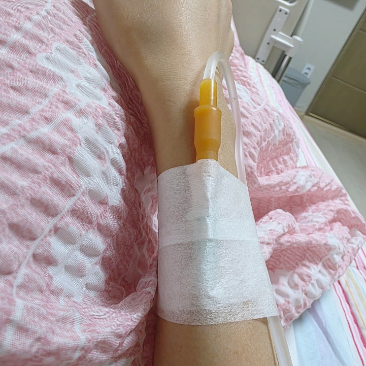  자궁 내막 폴립(용종) 제거 수술 후기 : 자궁경 검사 수술방법 비용 실비청구까지