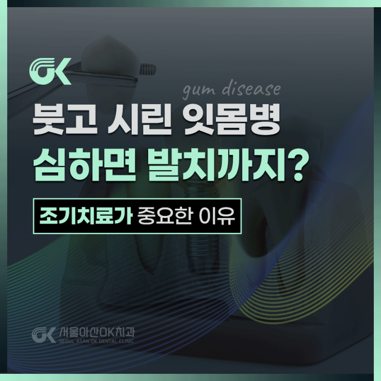 하남잇몸치료, 붓고 피나는 잇몸병 방치하면 발치까지?